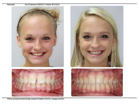 braces auburndale|Orthodontists Near Me in Auburndale, FL .